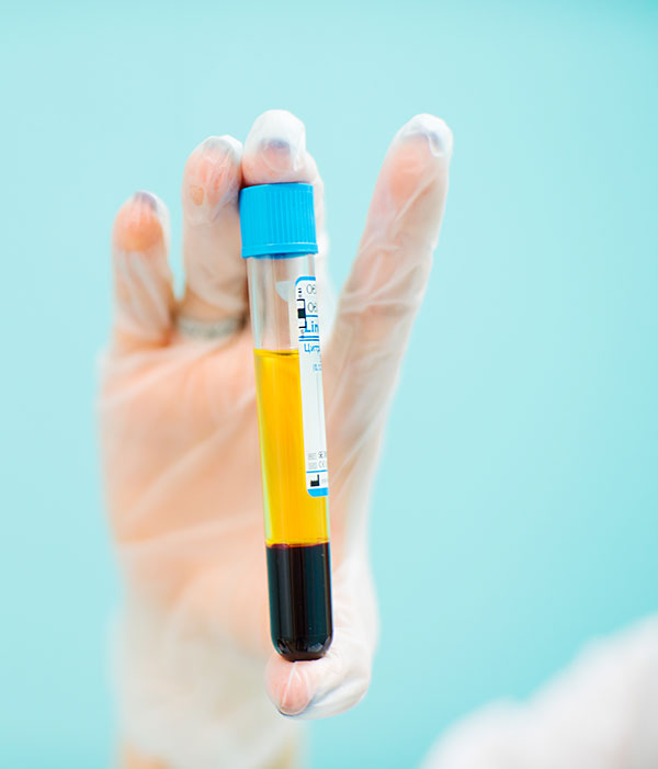 Platelet-Rich Plasma Facelift Houston