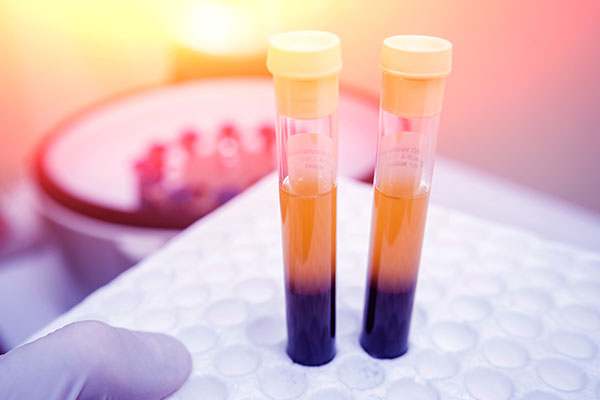 PRP Platelet Rich Plasma Houston